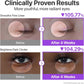 Volumetox Eye Cream 100 gm